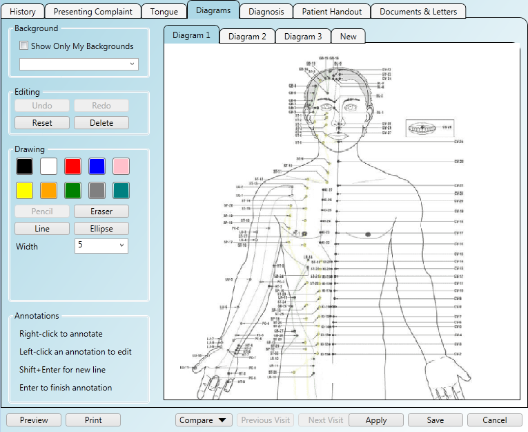 Using acupuncture diagrams in the patient notes area of the software