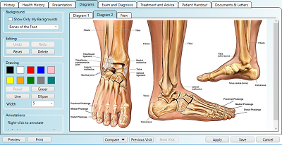 A colour diagram of a foot open in the podiatry notes