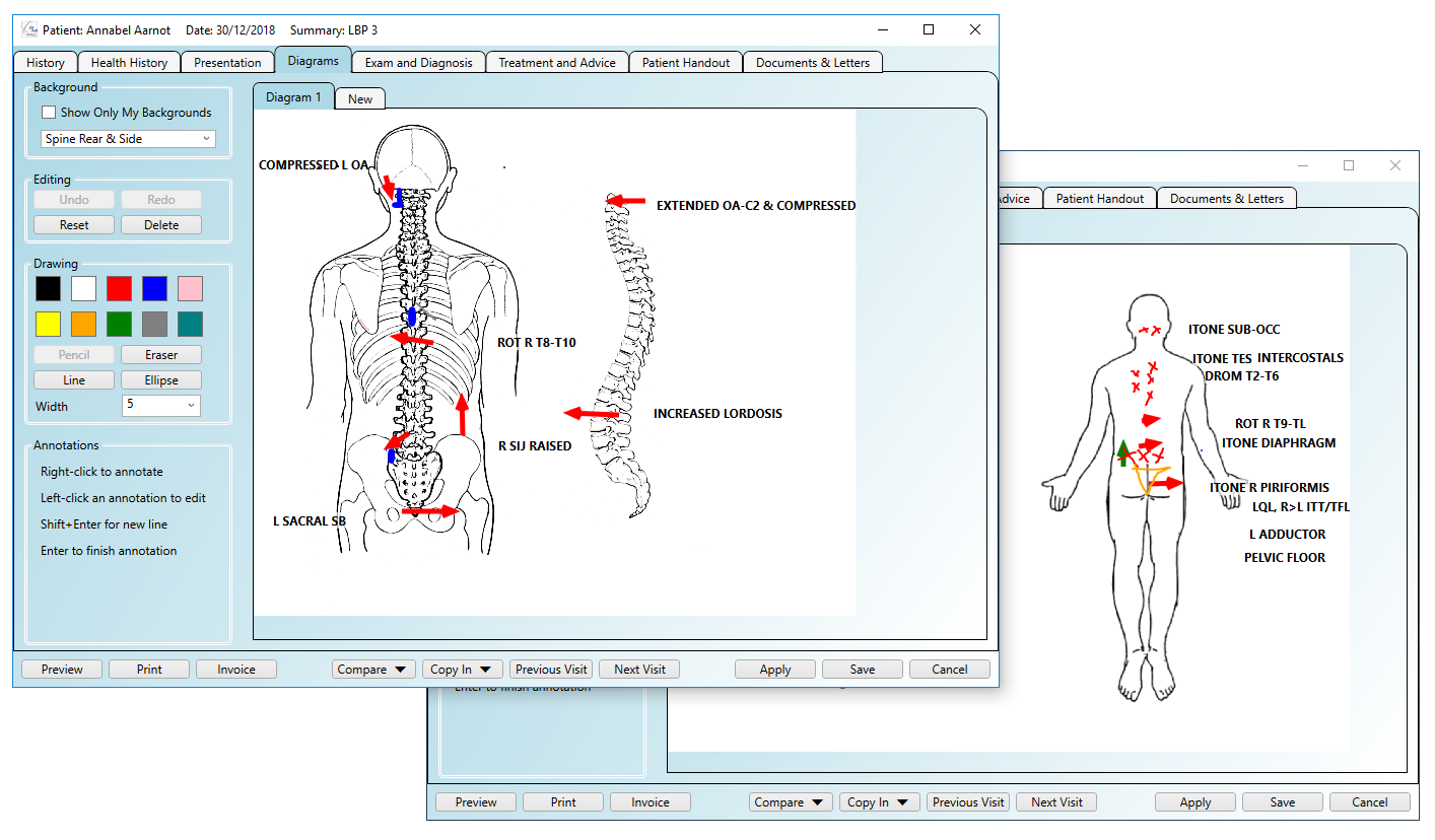 Annotated patient diagrams open in the software