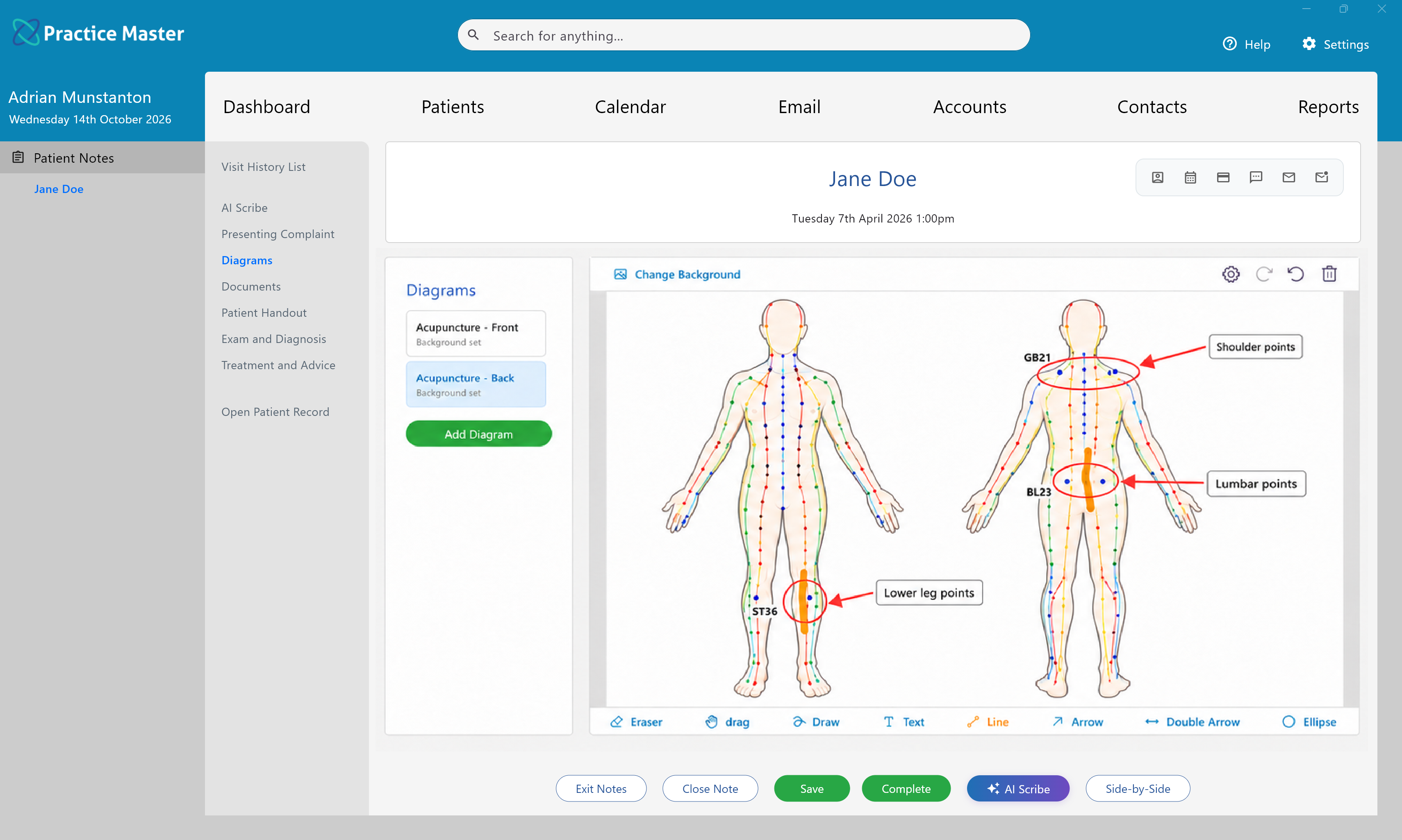 Diagrams tab showing acupuncture diagrams in Practice Master Pro patient notes