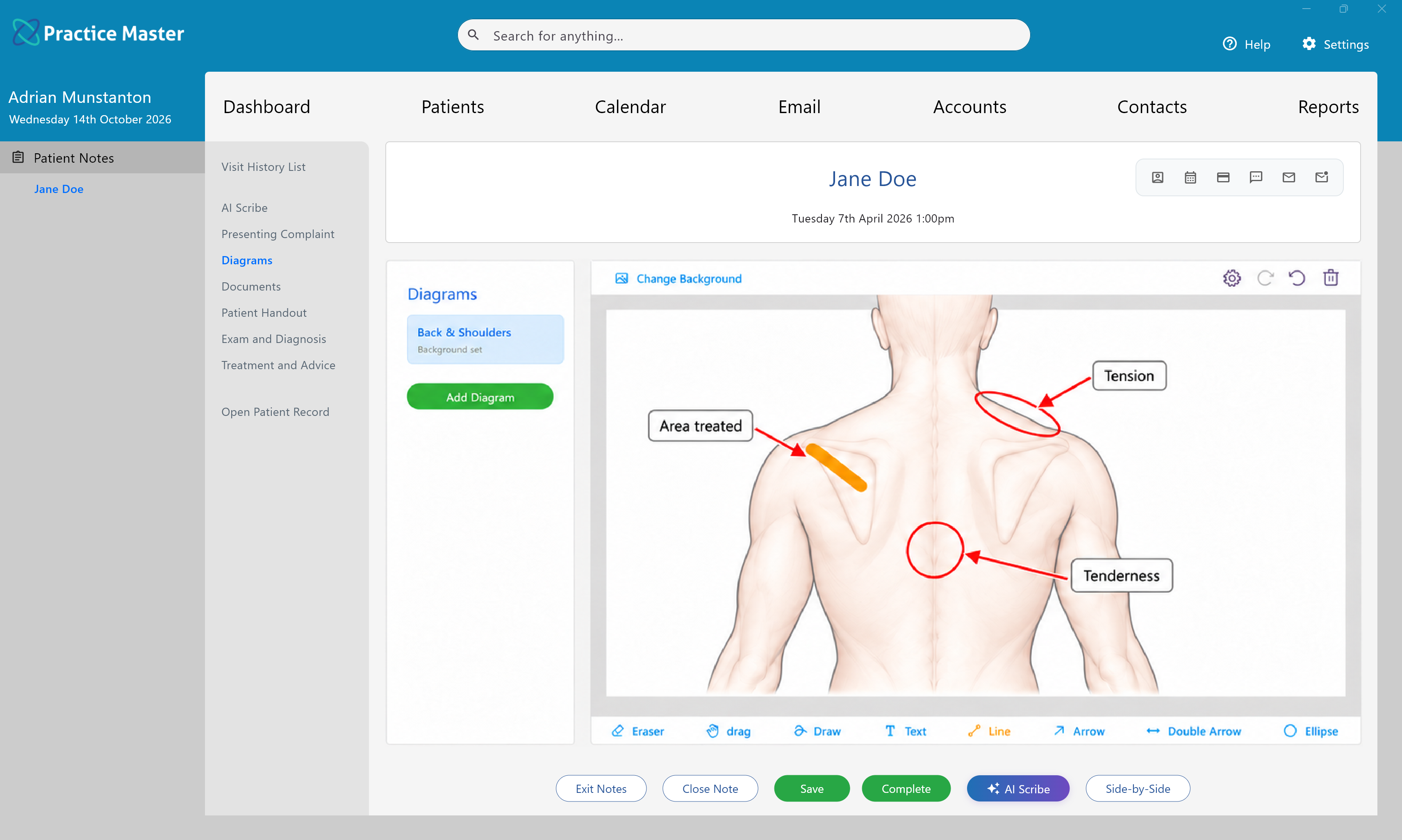Diagrams tab showing massage therapy diagrams in Practice Master Pro patient notes