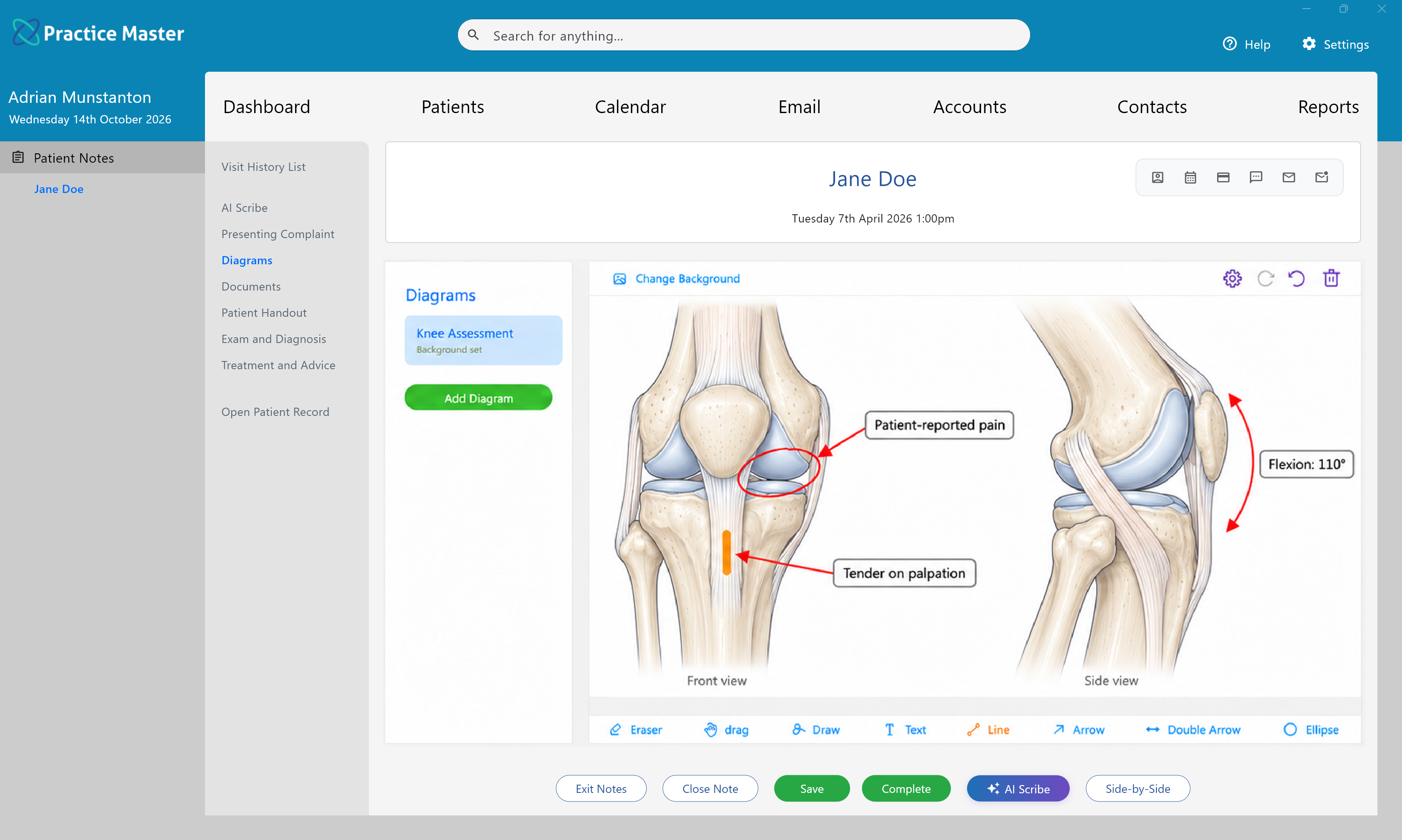 Diagrams tab showing physiotherapy diagrams in Practice Master Pro patient notes