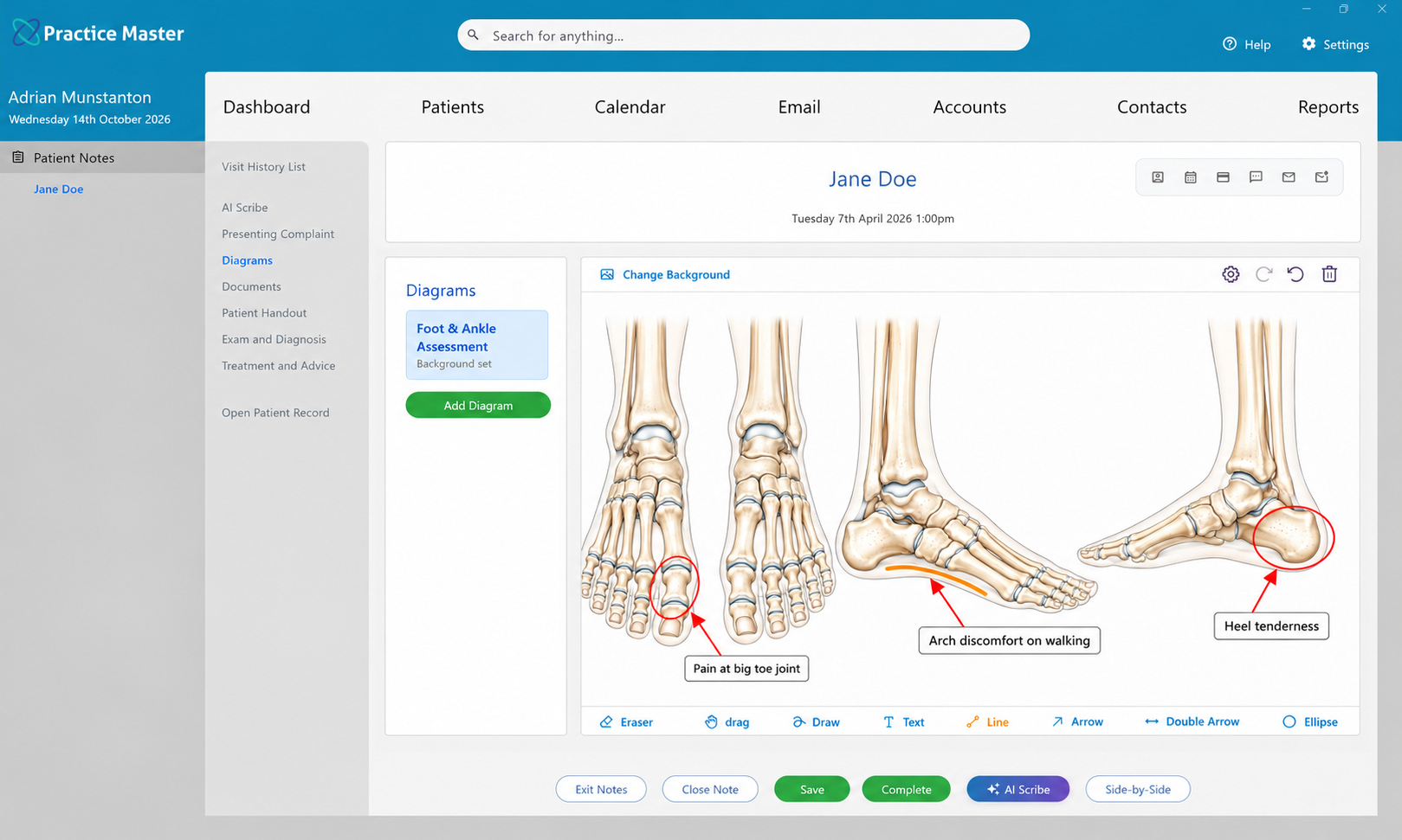 Diagrams tab showing podiatry diagrams in Practice Master Pro patient notes