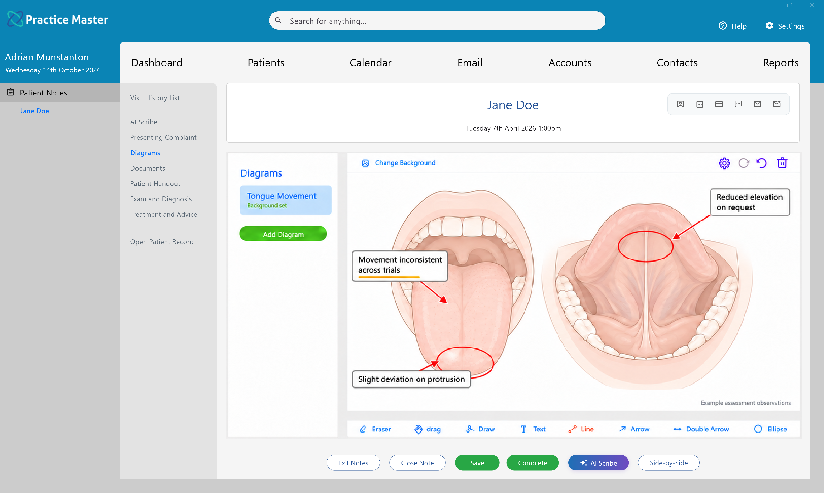 Diagrams tab showing speech therapy diagrams in Practice Master Pro patient notes