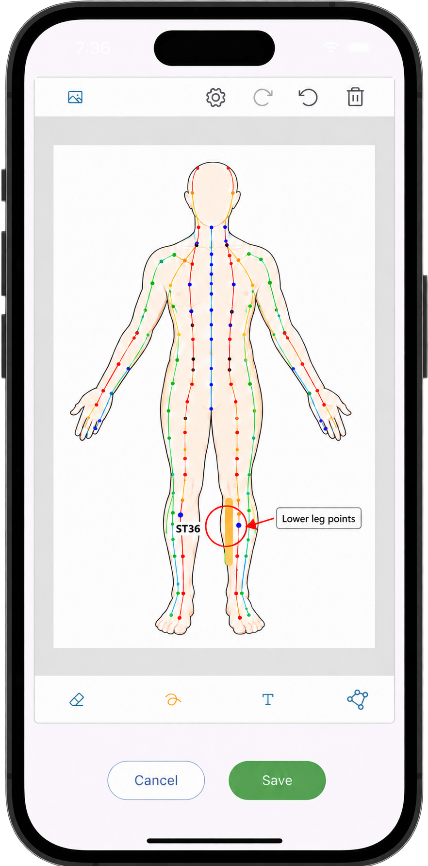 Diagrams tab showing acupuncture diagrams in Practice Master Pro patient notes