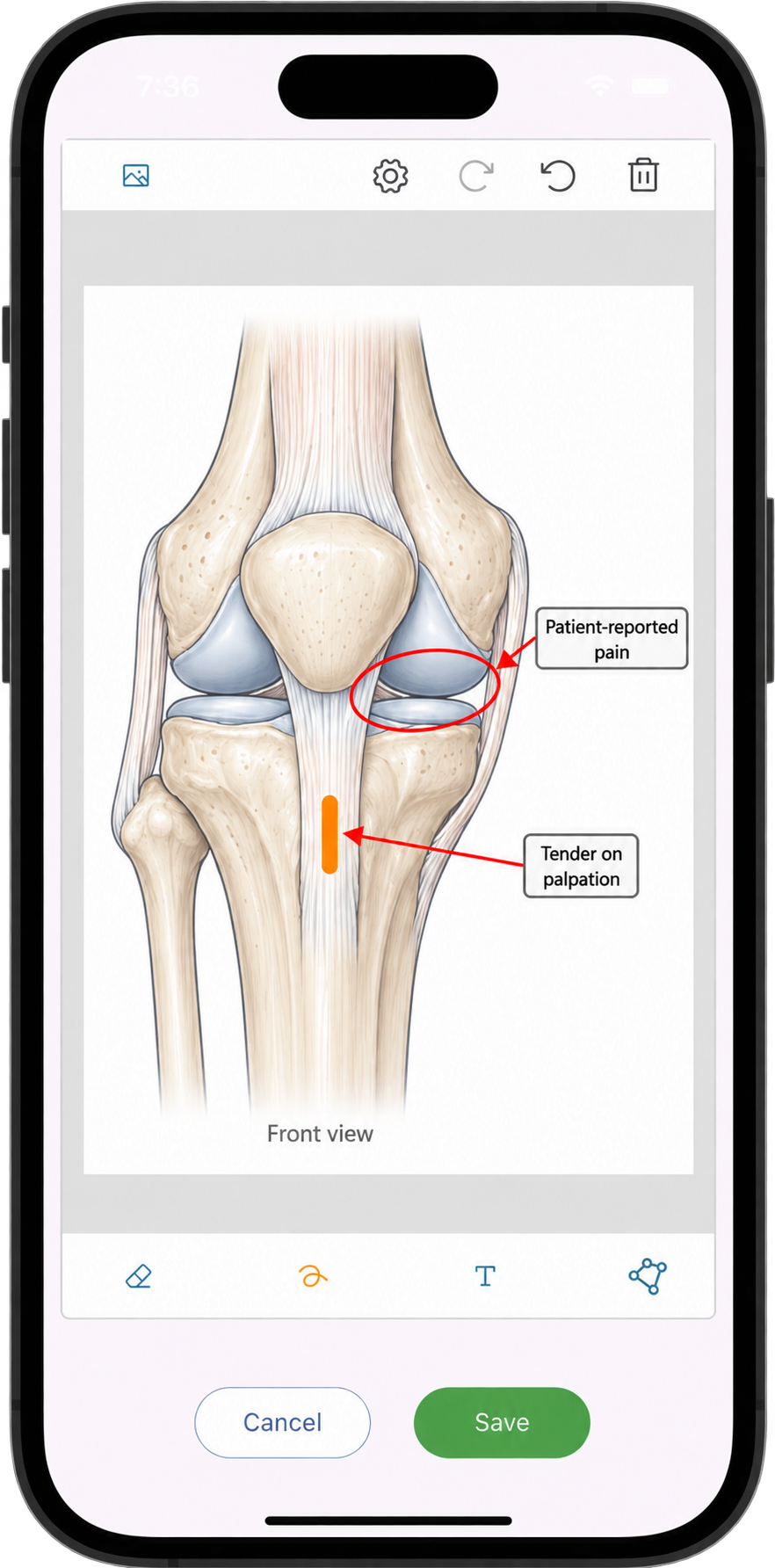 Diagrams tab showing physiotherapy diagrams in Practice Master Pro patient notes