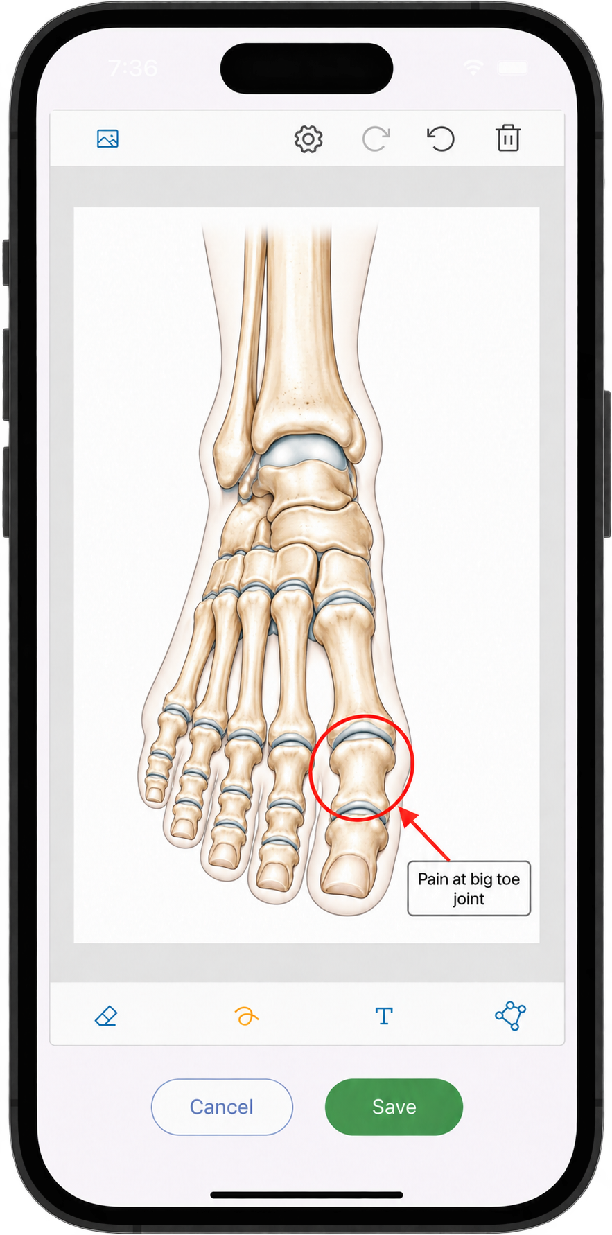 Diagrams tab showing podiatry diagrams in Practice Master Pro patient notes