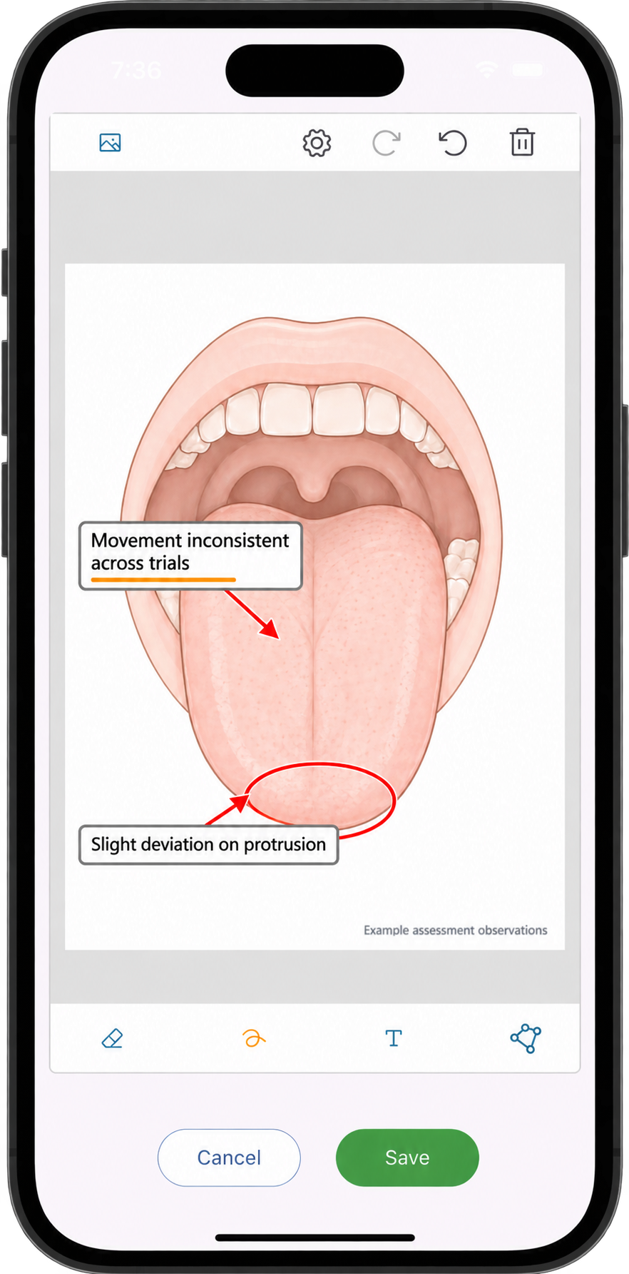 Diagrams tab showing speech therapy diagrams in Practice Master Pro patient notes